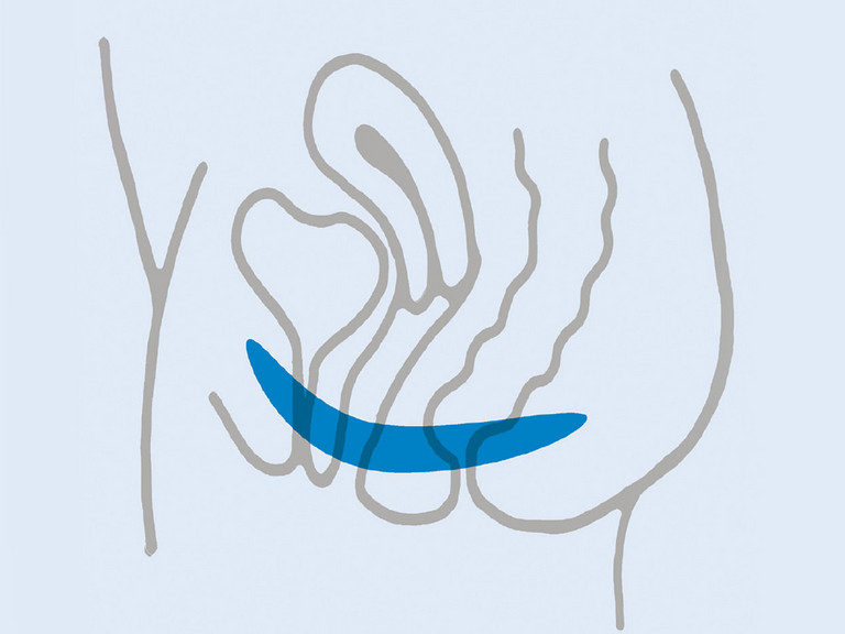 Vereinfachte Illustration eines weiblichen Unterleibs mit Beckenboden - Evangelisches Amalie Sieveking Krankenhaus in Hamburg - Beckenbodenschwäche Behandlung
