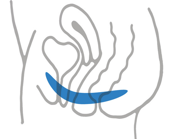 Vereinfachte Illustration eines weiblichen Unterleibs mit Beckenboden für die Beckenbodensprechstunde Urogynäkologie im Amalie Sieveking Krankenhaus in Hamburg